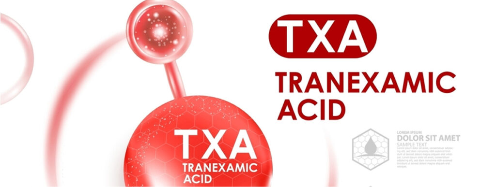 TXA Blog image